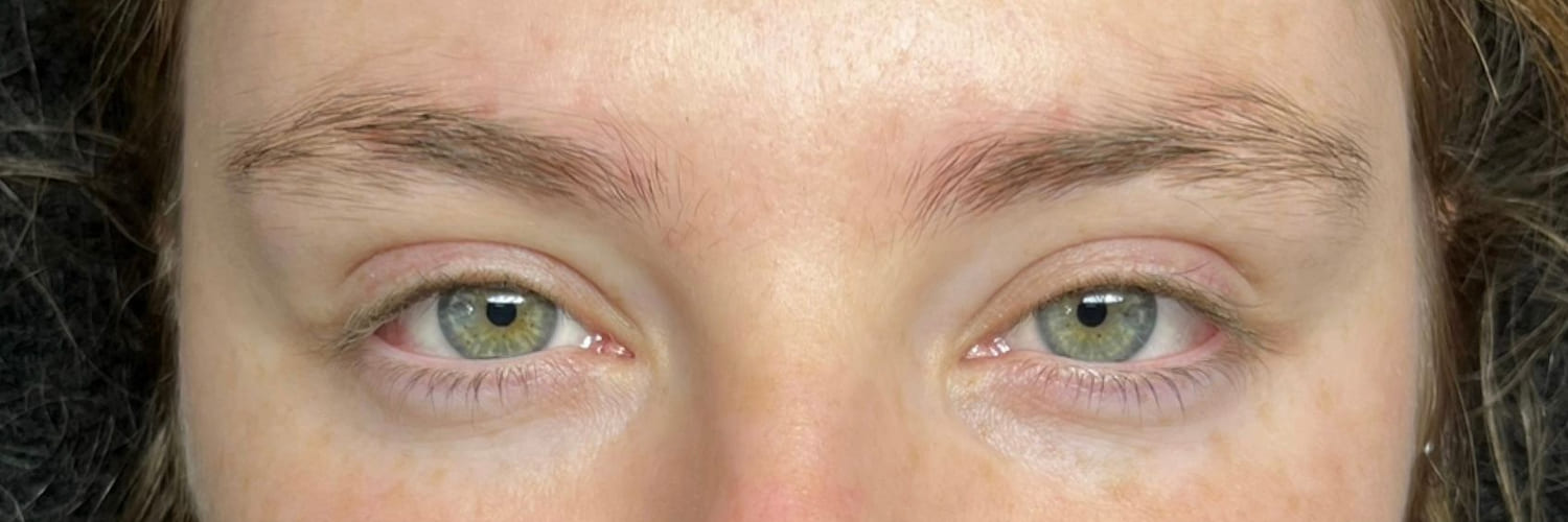 Natural lashes and unshaped brows before a 10D volume set and brow lamination