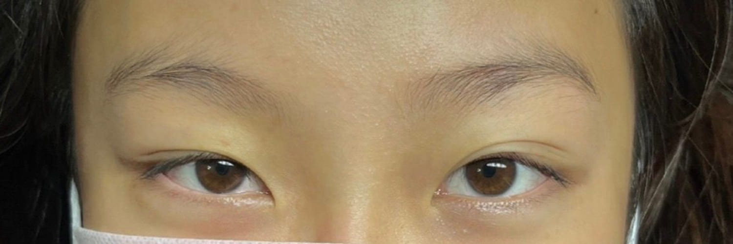 Natural lashes and untinted brows before treatment