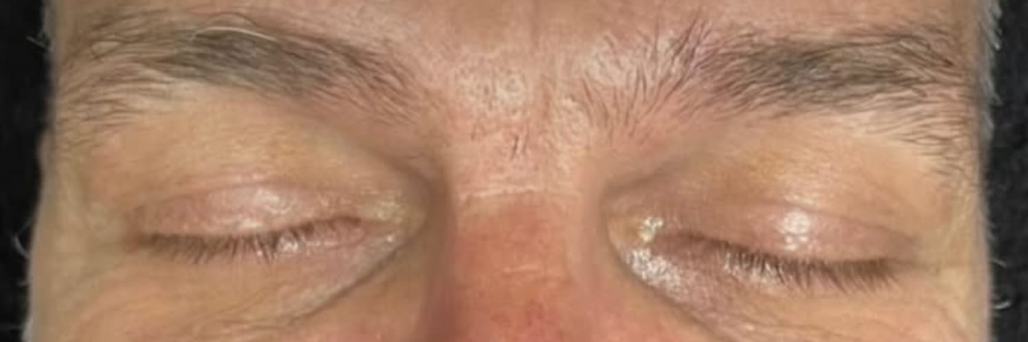 Heavy, untidy brows before a brow shape